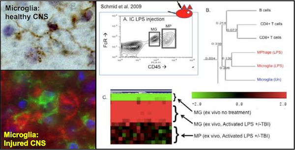 Explaining how the brain and blood play well together in Brain Health in Disease